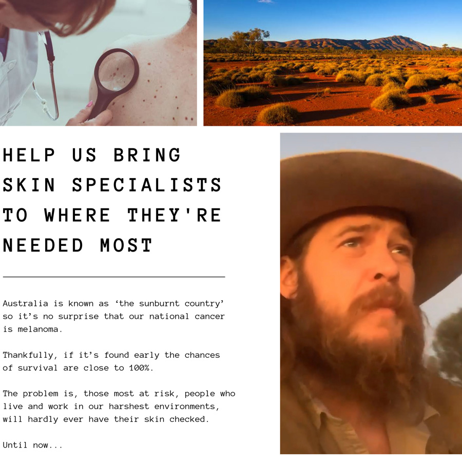 Beards for bush